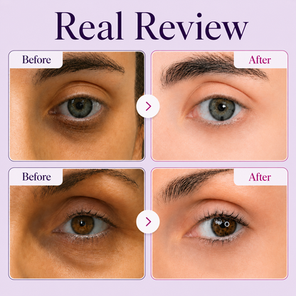 GROWZUME™ Calcium Dark Spot Eye Cream
