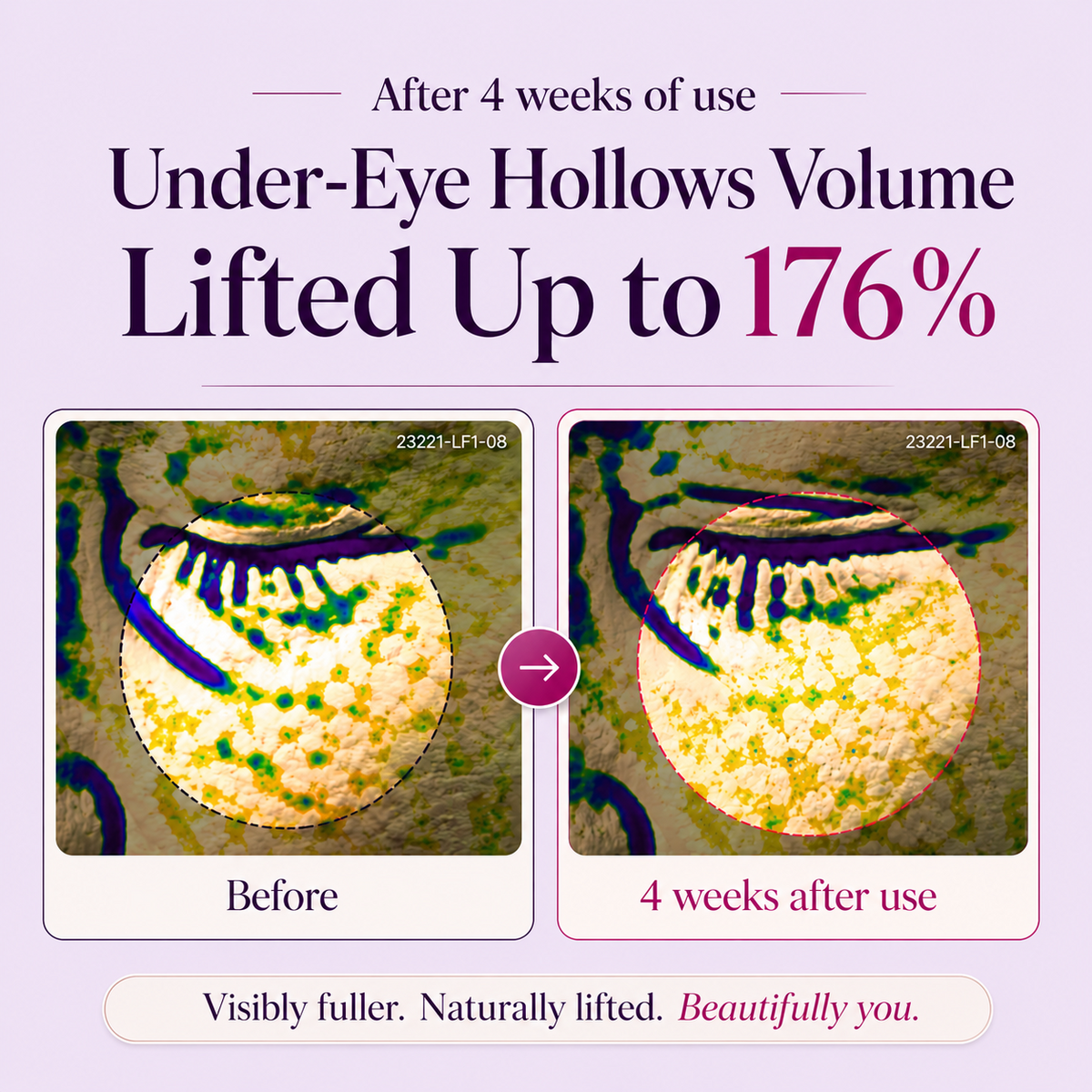 GROWZUME™ Calcium Dark Spot Eye Cream