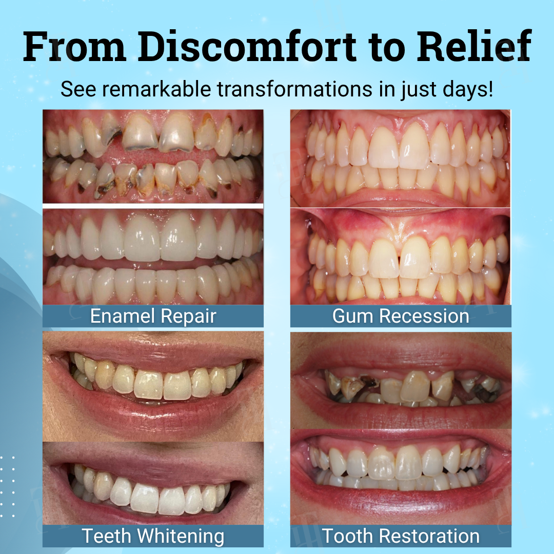 Growzume® Non-Surgical Gum "Suture" Gel